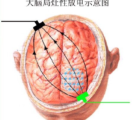 晋江无痛人流病医院