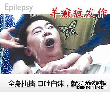 无痛人流治疗前 注意